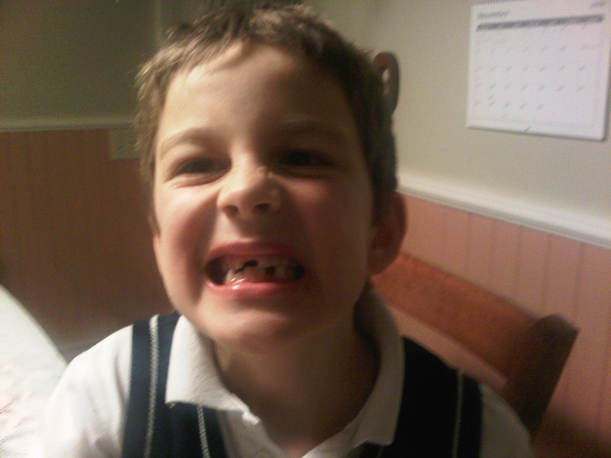 On perd nos dents (Novembre 2011)